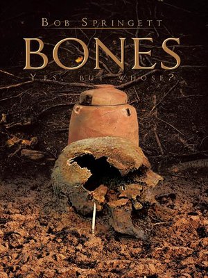 cover image of Bones